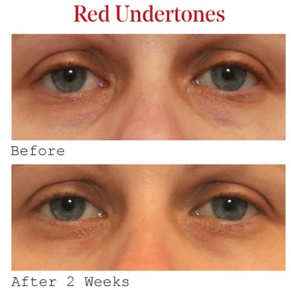 MURAD VITA-C EYES DARK CIRCLE EYE CORRECTOR. - Picture 5 of 7